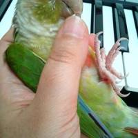まーりんさん 大腸がん