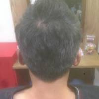 タクヤさん 膵（すい）臓がん